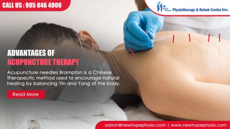 Advantages Of Acupuncture Therapy