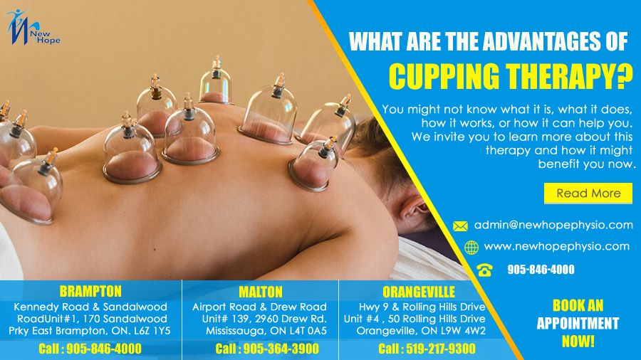 What are the Advantages of Cupping Therapy? | New Hope Physio