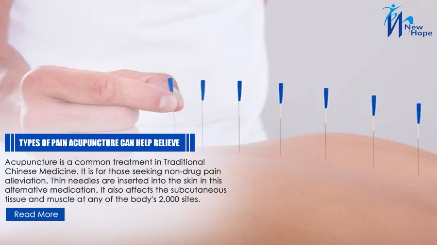 Types of Pain Acupuncture can help Relieve