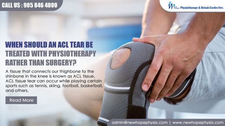 When should an ACL tear be treated with physiotherapy rather than surgery