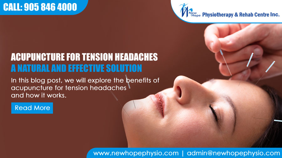 Acupuncture for Tension Headaches: A Natural and Effective Solution