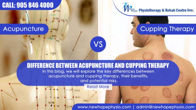Difference Between Acupuncture and Cupping Therapy
