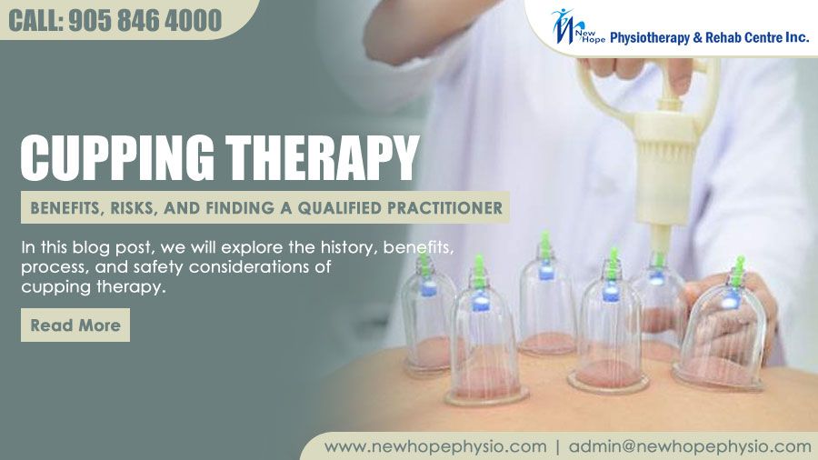 Cupping Therapy: Benefits, Risks, and Finding a Qualified Practitioner