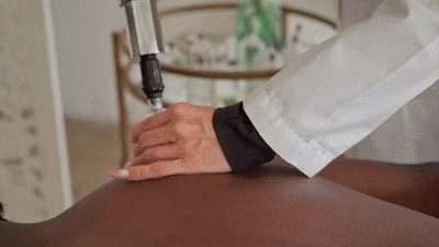 Cupping Therapy