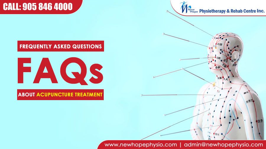 FAQs About Acupuncture Treatment