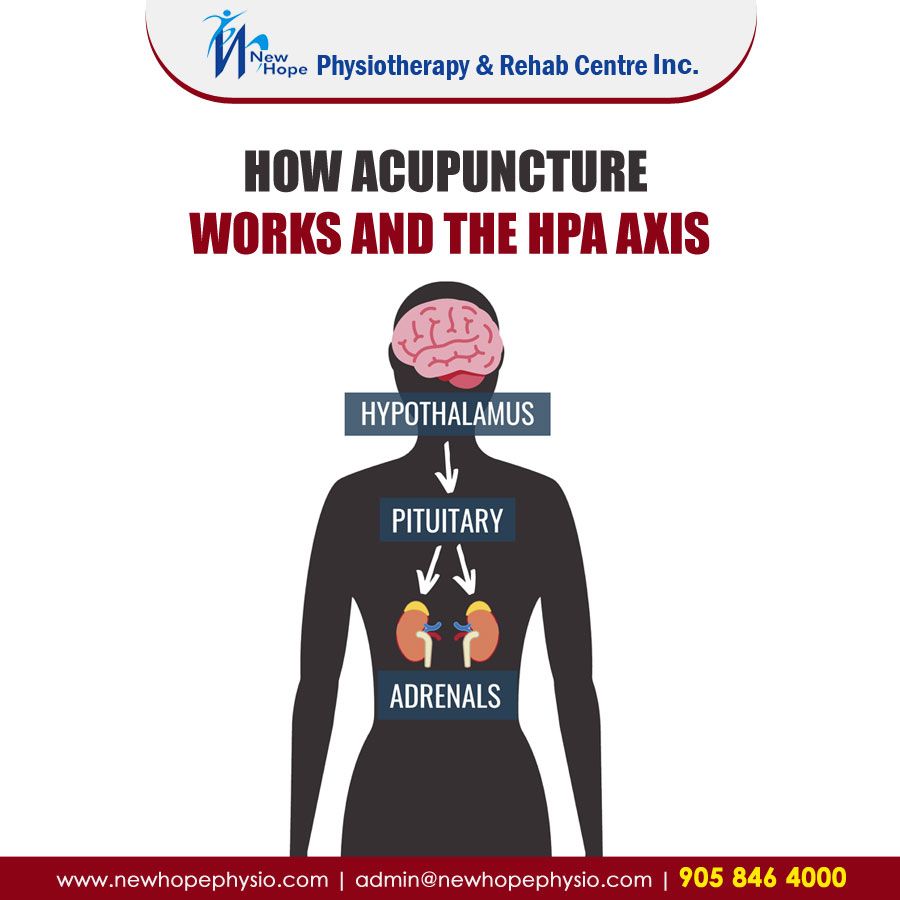 How Acupuncture Works and the HPA Axis