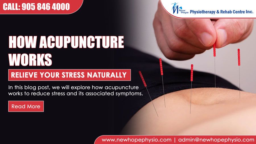 Relieve Your Stress Naturally: How Acupuncture Works