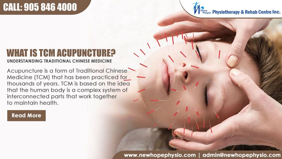 What is TCM Acupuncture? Understanding Traditional Chinese Medicine