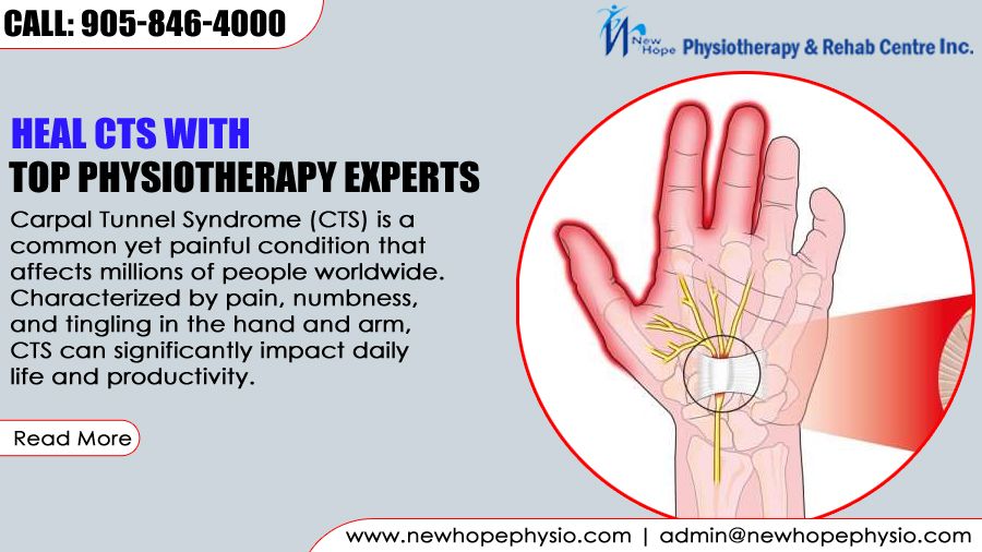 Heal CTS with Top Physiotherapy Experts