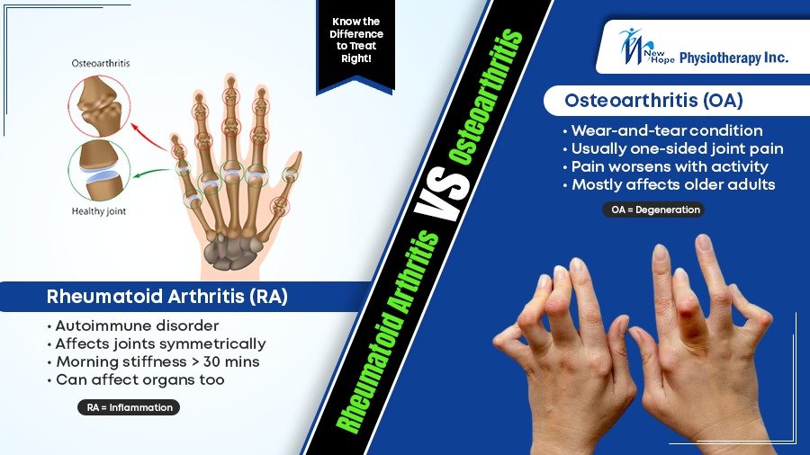Rheumatoid Arthritis vs. Osteoarthritis: Key Differences Explained 