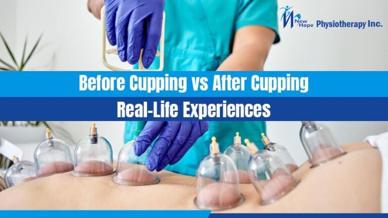 Before Cupping vs. After Cupping