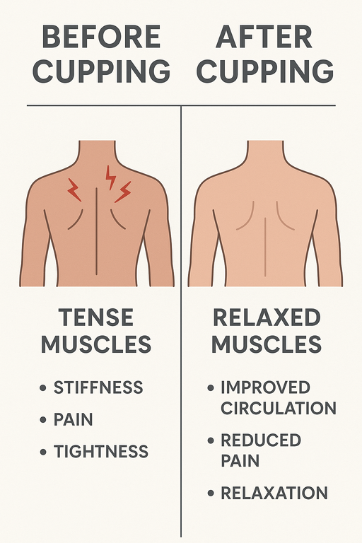 Before Cupping vs. After Cupping