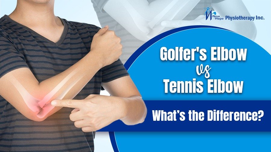 Golfer’s Elbow vs. Tennis Elbow: What’s the Difference? 