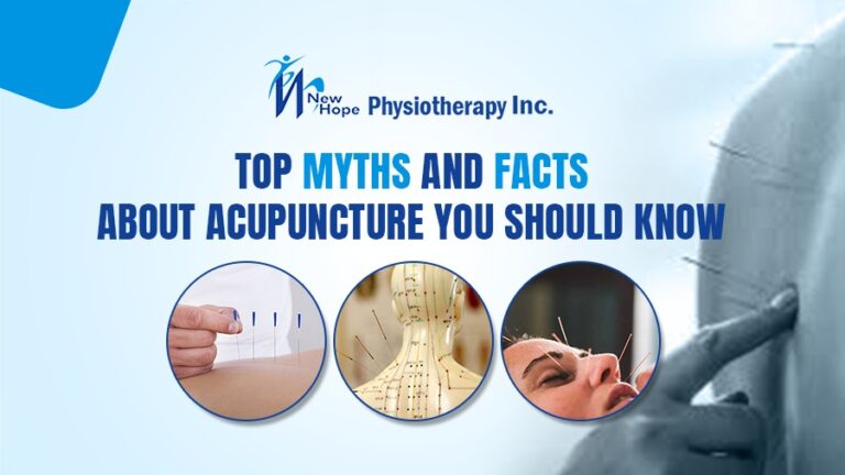 Acupuncture