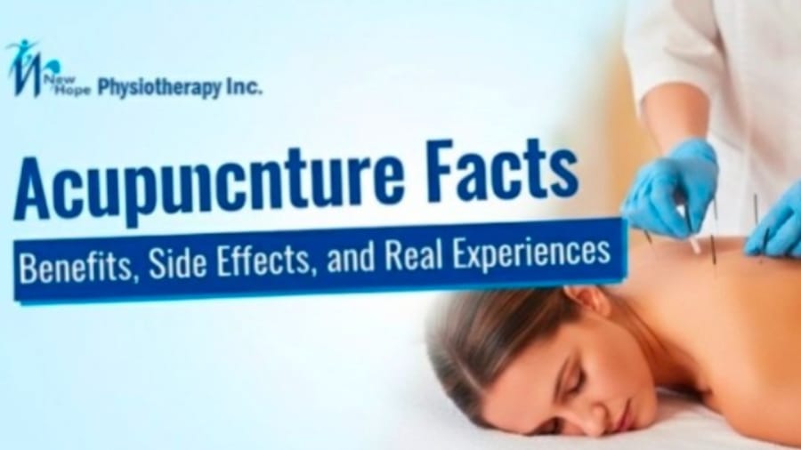 Acupuncture Facts: Benefits, Side Effects, and Real Experiences