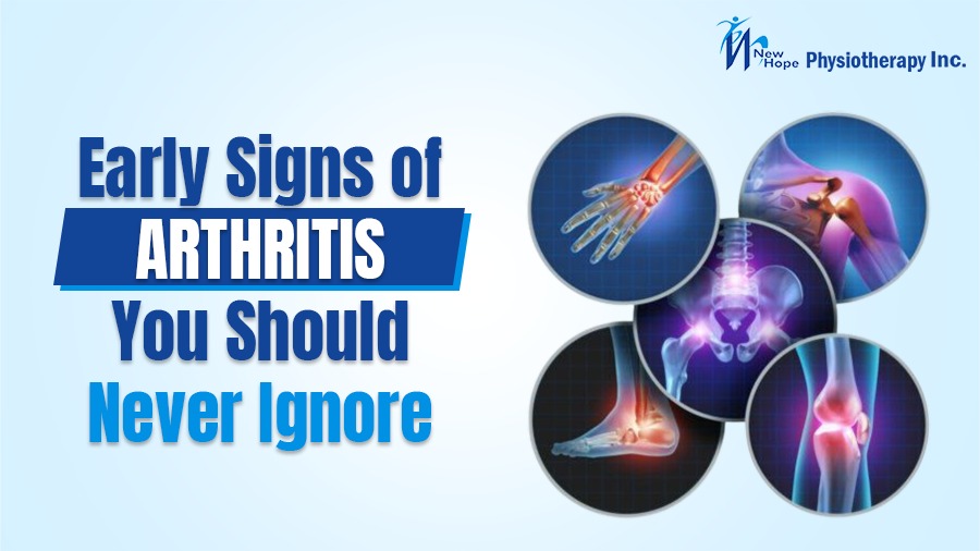 Early Signs of Arthritis You Should Never Ignore 