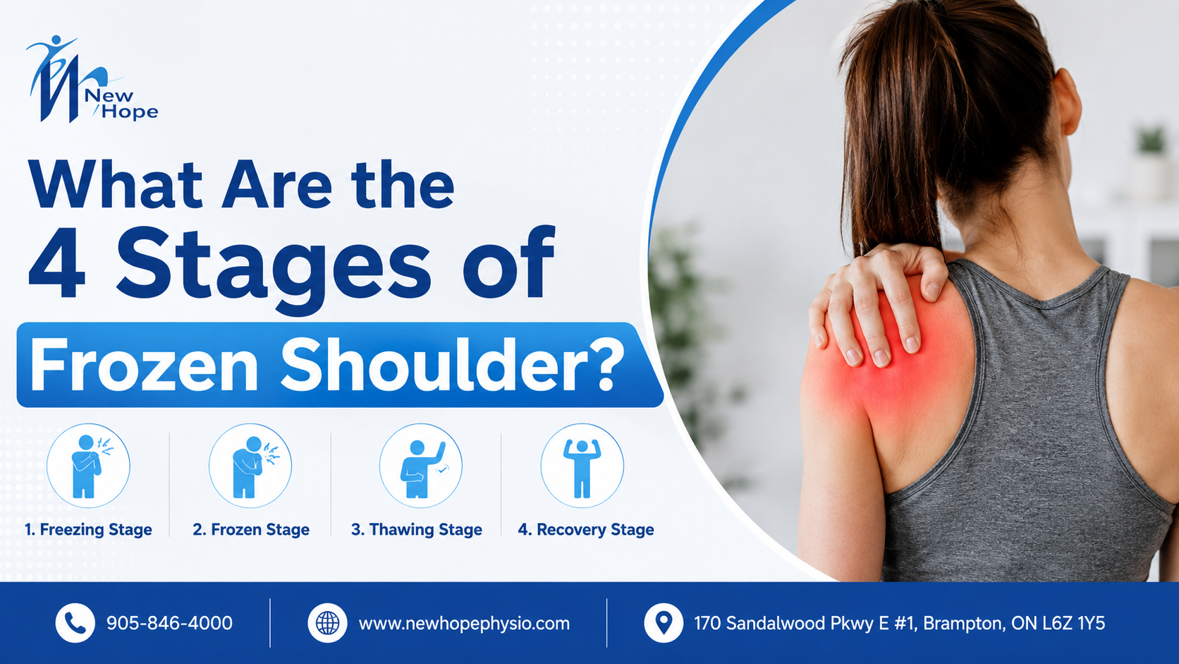 What Are the 4 Stages of Frozen Shoulder?