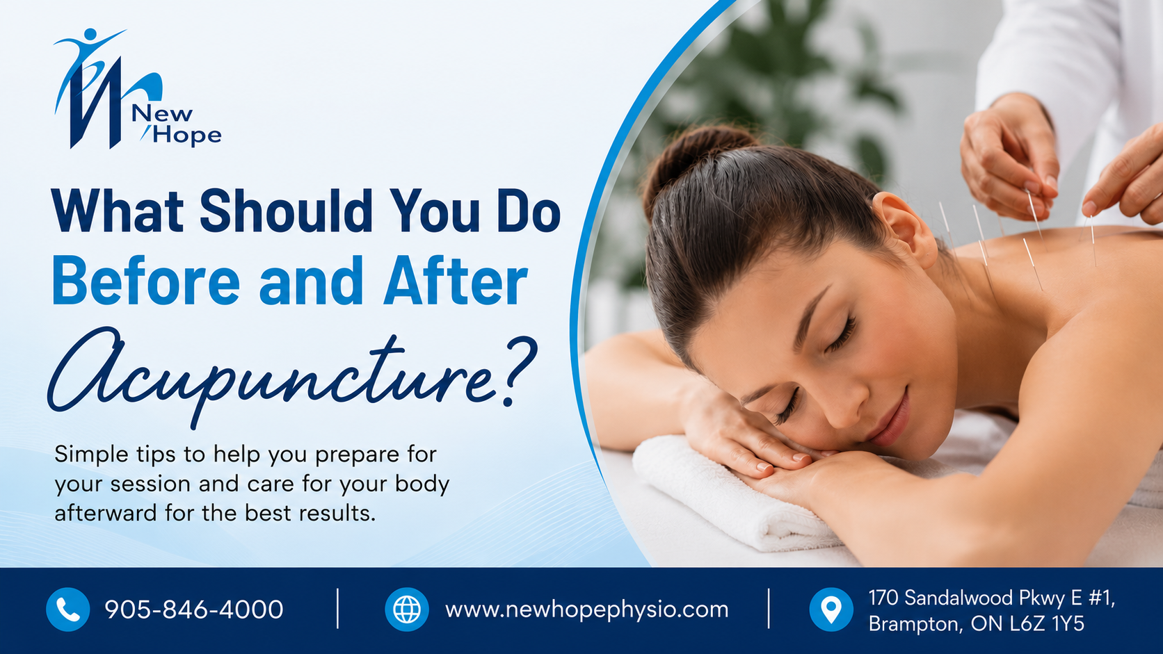 What Should You Do Before and After Acupuncture?