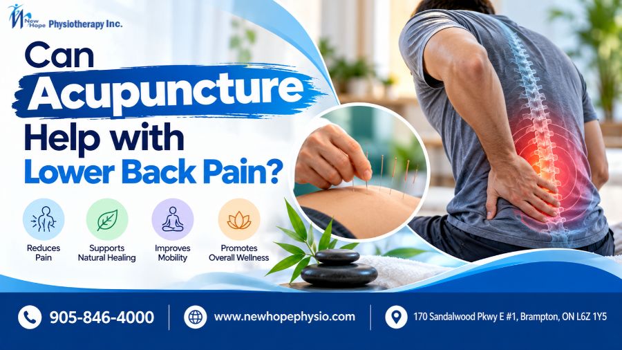 Acupuncture for lower back pain treatment to help manage back discomfort, muscle tension, and sciatica symptoms.