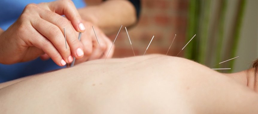 Advantages of Acupuncture Therapy